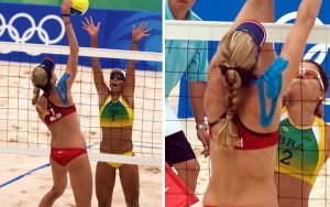 The Silent Star of the Olympics: Kinesio Tape