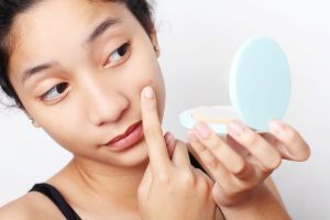 The Cure to Acne May Already Be On Our Skin