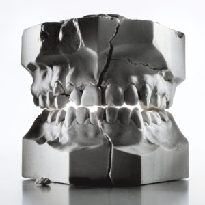 How Stress Might Be Ruining Your Teeth