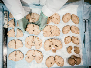 I’m a Neuroscientist Who Studies Mental Illness. Here’s What Happened When I Lost My Own Mind.