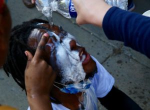 Civil Rights Groups Sue Trump and Barr Over Assault on Lafayette Square Protesters