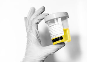 Why Is Pee Yellow? Maryland Researchers Solve This Wee Mystery.