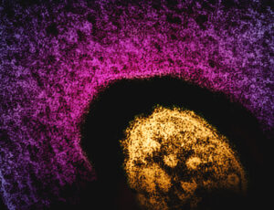 A Doctor’s Advice on Protecting Yourself From Measles